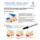 FISSURE SEALANT герметик без адгезива, 1 гр., ARKONA