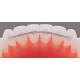 Ретейнер лингвальный плоский в прутках BOND-A-BRAID, G&H Orthodontics