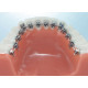 Металлические брекеты Экспириенс L, GC Orthodontics